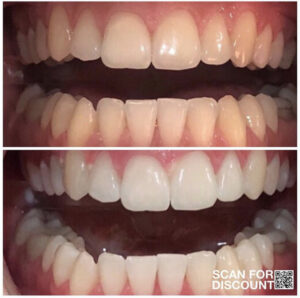 AP24 Whitening Fluoride Toothpaste Testimonial 1