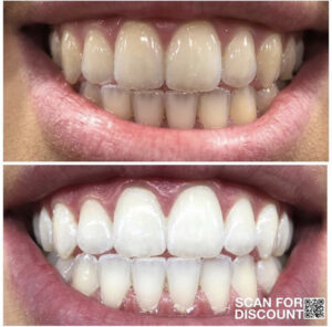 AP24 Whitening Fluoride Toothpaste Testimonial 2