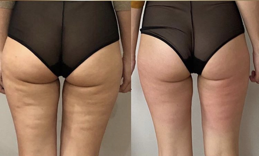 Nu Skin ageLO Dermatic Effect Body Contouring Lotion Price