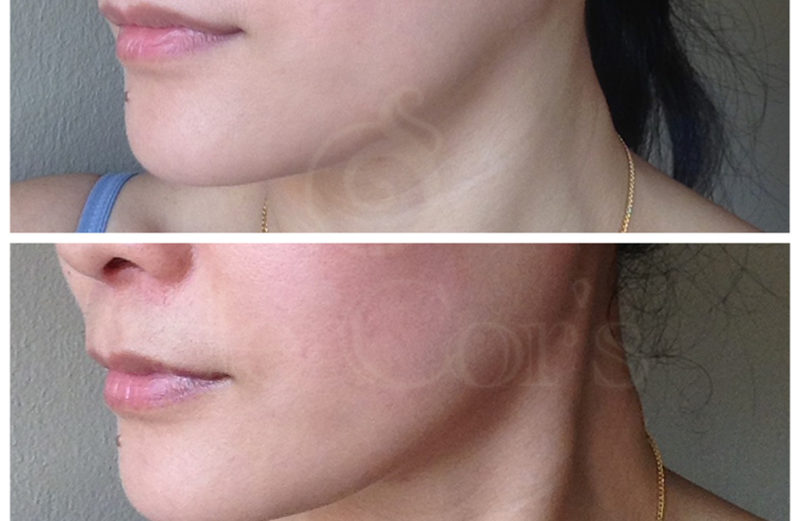 Product Review: Malaysia Nu Skin Face Lift Powder and Activator