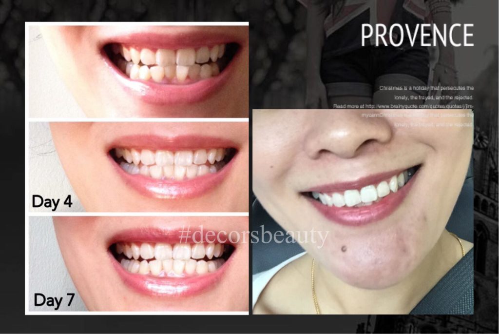 How to Buy AP-24 Whitening Toothpaste at Wholesale Price or Use it for Free
