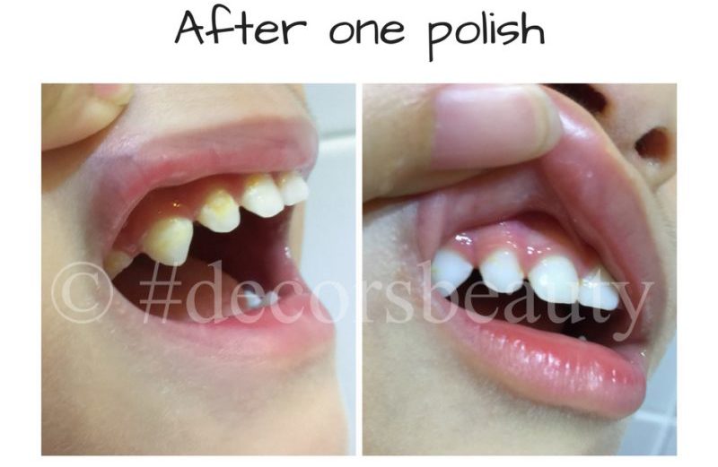 Remove Stubborn Stains with AP-24 Whitening Toothpaste