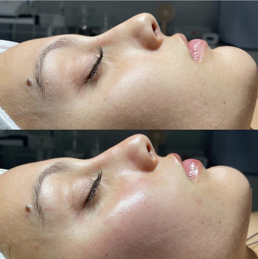 Nu Skin 180°® AHA Facial Peel and Neutralizer