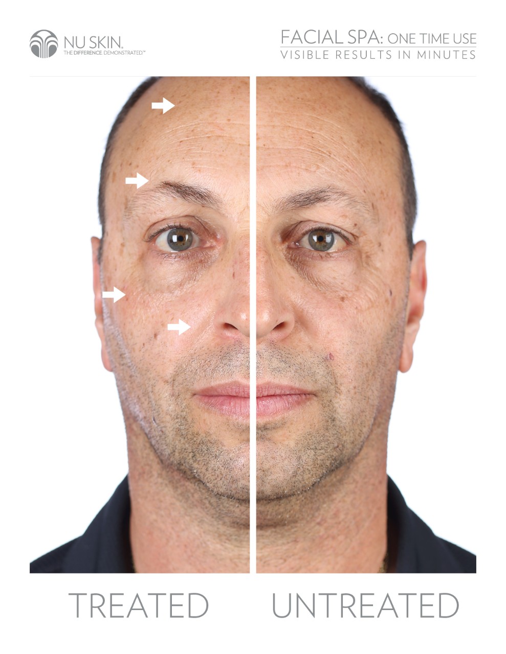 Nu Skin Galvanic Facial Spa Testimonial