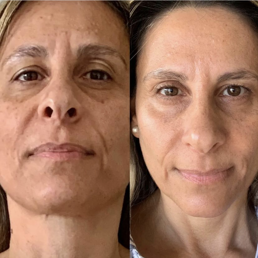 Beauty Focus Collagen+ + Celltrex Always Right Recovery Fluid Subscription Testimonial